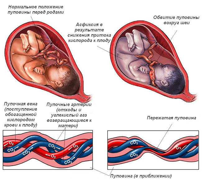 Как подготовиться к эпизиотомии при родах: Секреты спокойного материнства