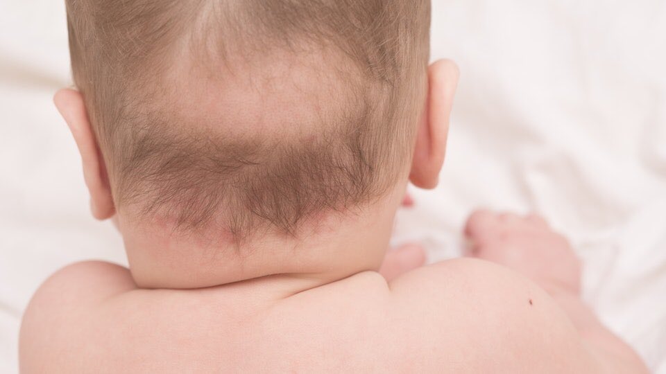 Можно ли подстричь ребенка в год если родничок не зарос