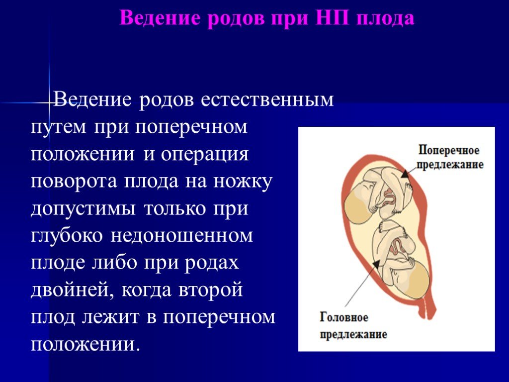 Положение родов. Неправильное положение плода. Ведение родов при поперечном положении плода. Роды при поперечном положении плода. Диагностика поперечного положения плода.