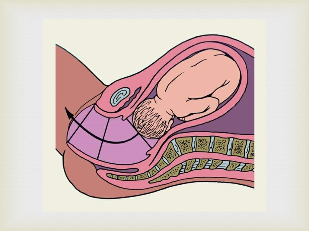 Как добиться раскрытия 7 см быстро и безопасно: Секреты успешных родов