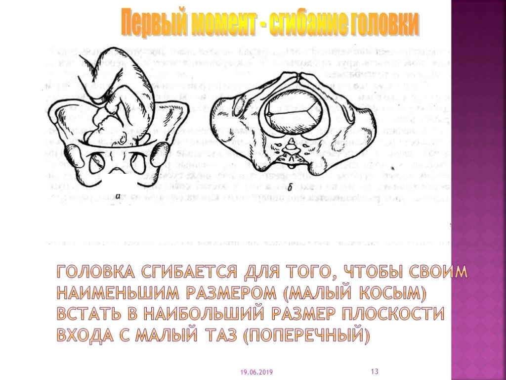 Размеры головки таза. Плоскости головки плода. Головка большим сегментом во входе в малый таз. Плоскость входа в малый таз.