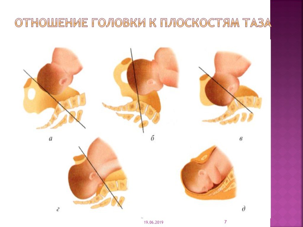 После открытия головки. Отношение плода к плоскостям малого таза. Плоскости головки плода. Отношение головки к плоскостям таза. Отношение головки плода к плоскостям таза.