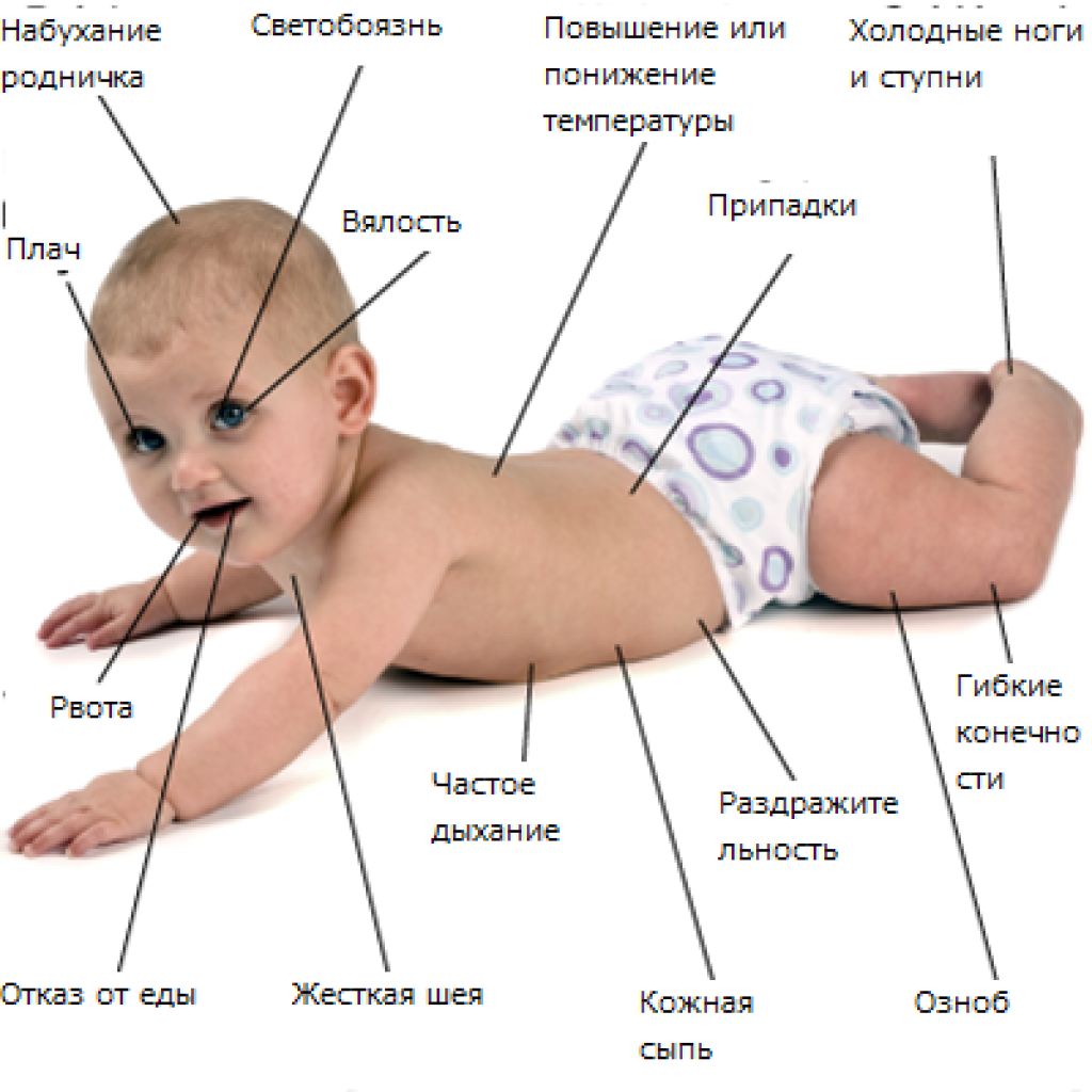 Как распознать менингит у ребенка: Советы доктора Комаровского