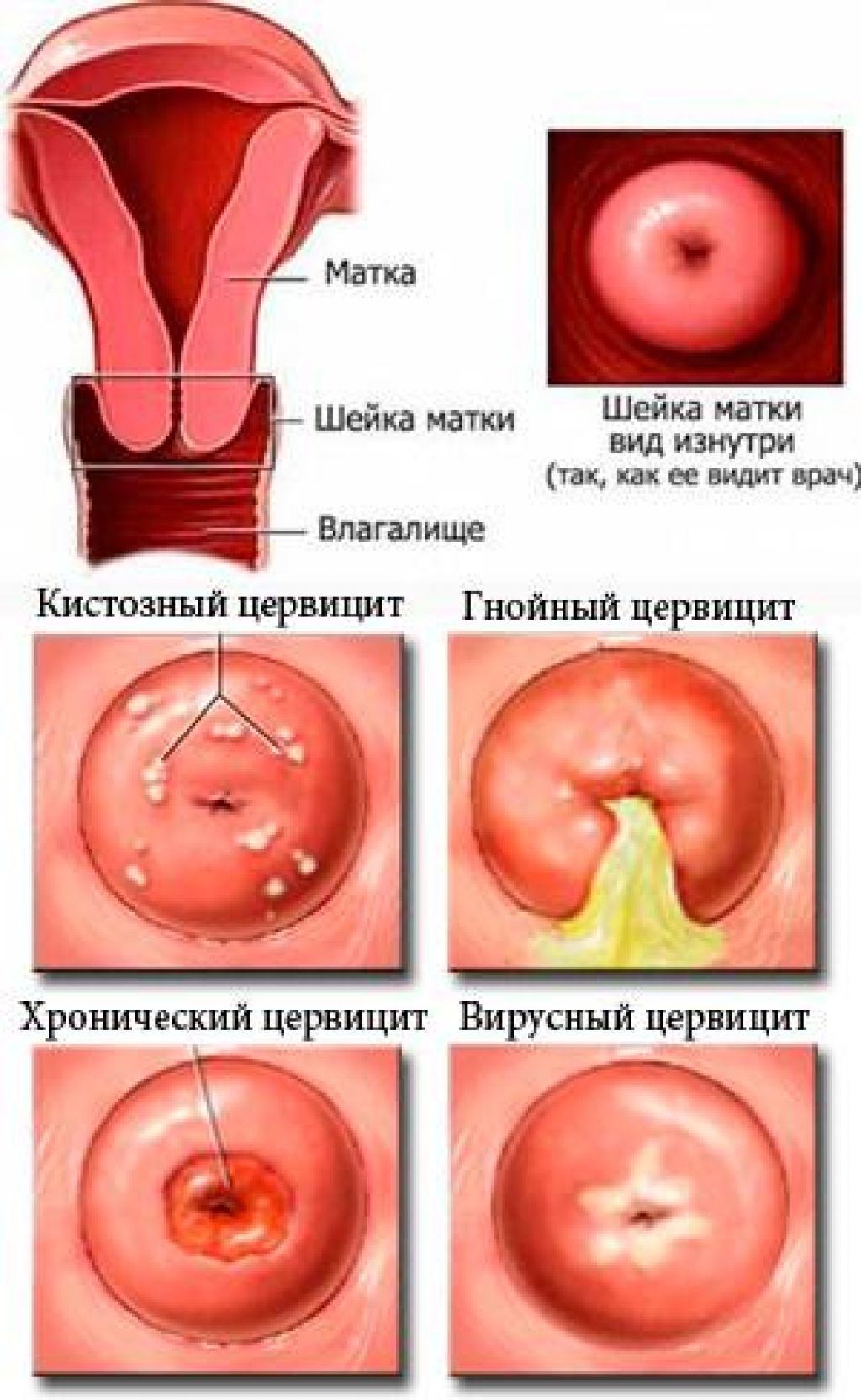 Где находится шейка матки картинка