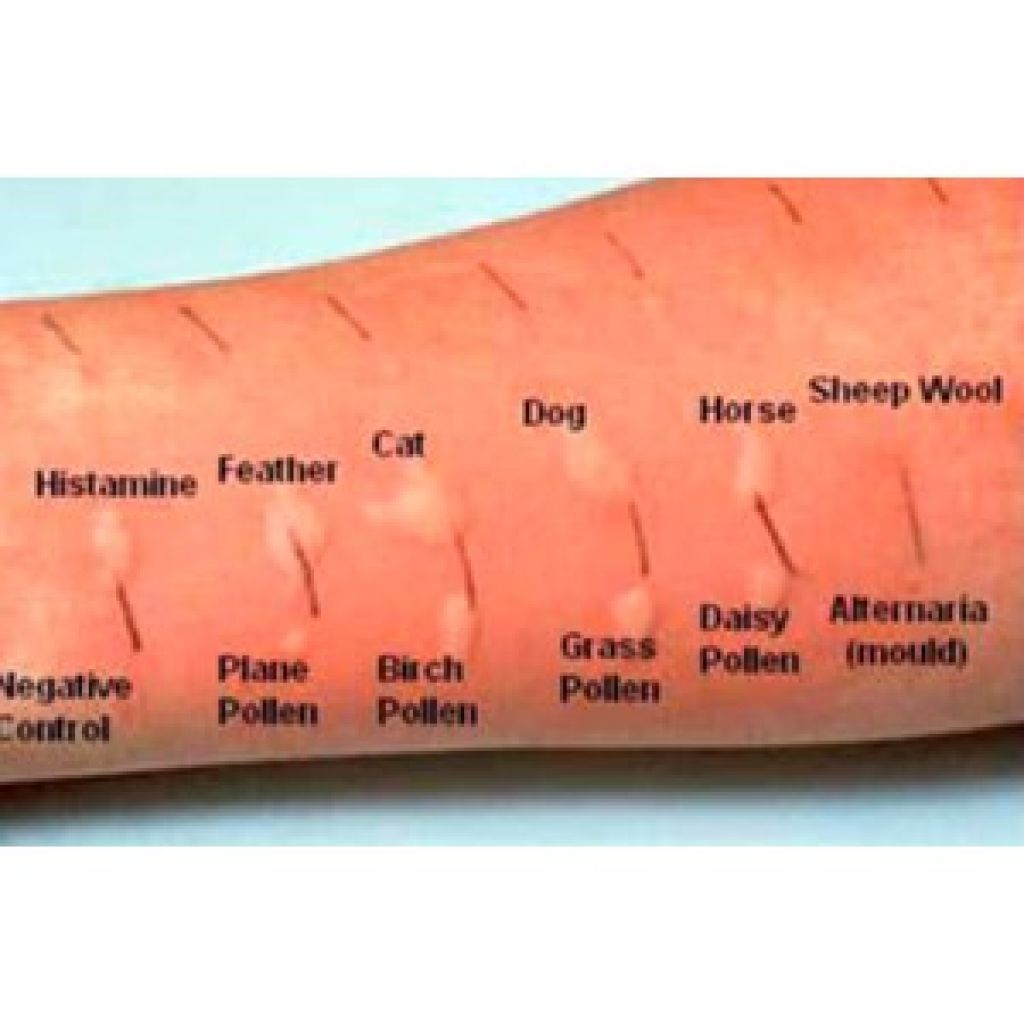 Как распознать аллергию у детей на животных: Секреты быстрой диагностики