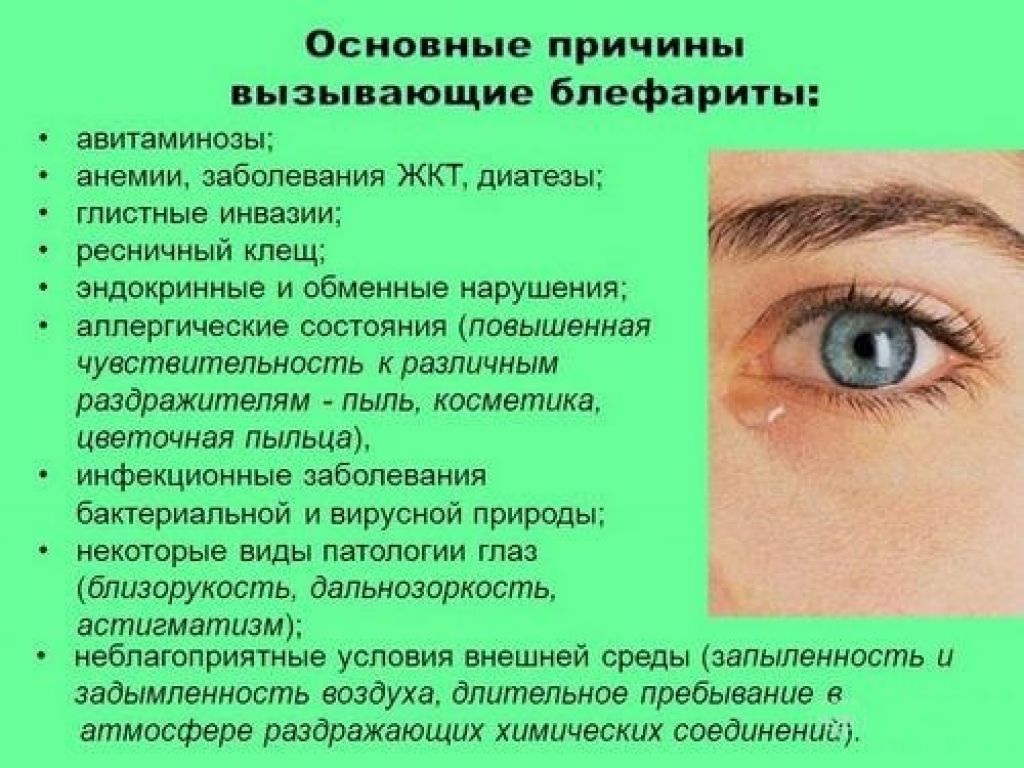 Секрет слезных желез. Блефарит причины возникновения. Заболевание глаз блефарит.