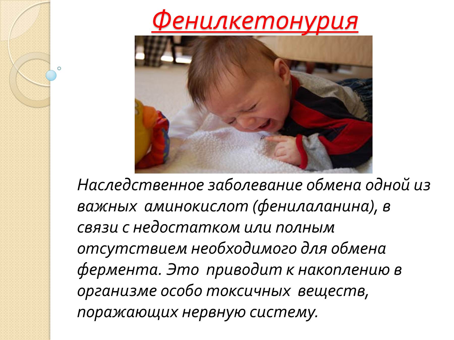 Что такое фенилкетонурия. Фенил кетон. Болезнь фенилкетонурия. Фенилкетонурия это наследственное заболевание.