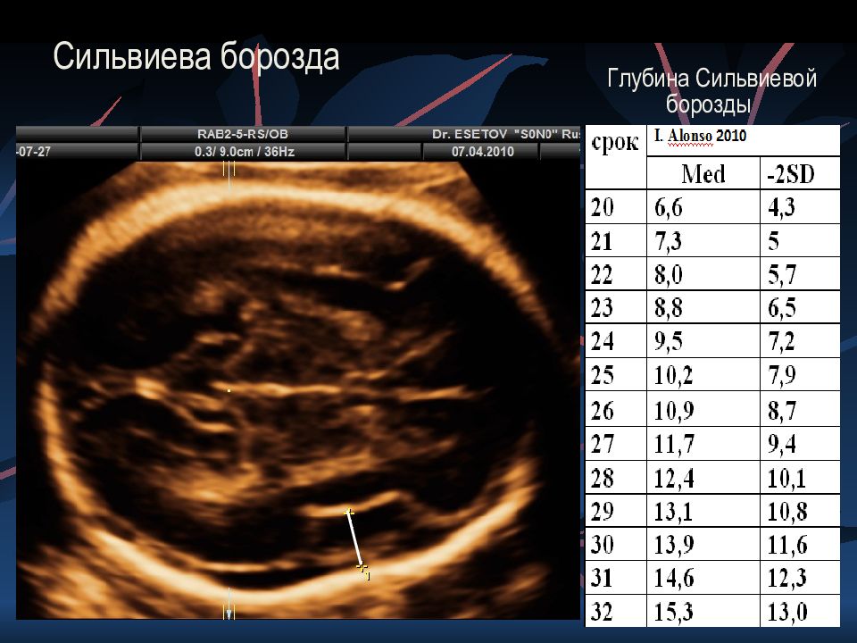 Как измерить малыша в утробе: Точный расчет размеров плода по УЗИ