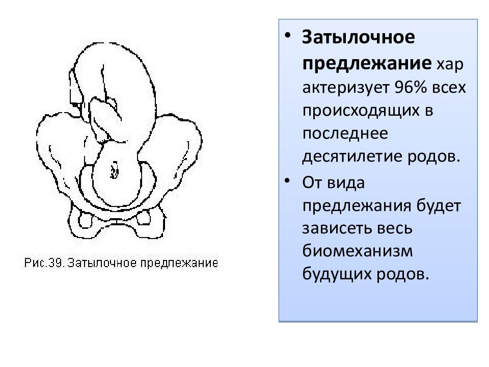 Как проходят роды при заднем виде затылочного предлежания: Путь к безопасному рождению