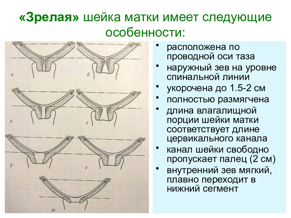 Как понять, что скоро роды: Раскрытие шейки матки на 2 см