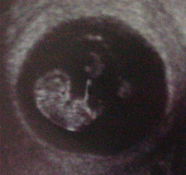 Узи плода 8 неделе. УЗИ 9 недель беременности фото. Эмбрион на 8-9 неделе беременности УЗИ. Плод на 9 неделе беременности УЗИ. 9 Недель беременности фото плода на УЗИ.