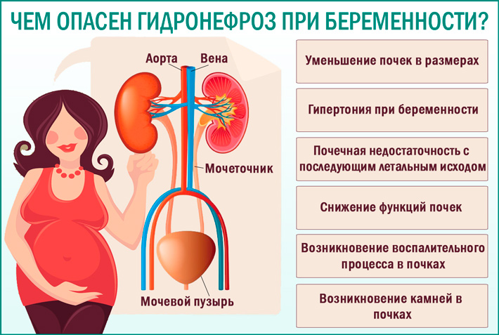 Беспокоит низкий ИЦН при беременности: Секреты комфортного вынашивания