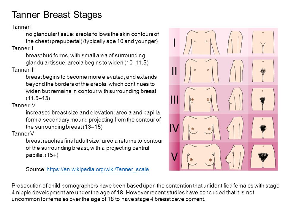 Половое развитие по таннеру. Стадии полового развития девочек. Этапы развития груди. Этапы роста груди. Развитие женской груди.