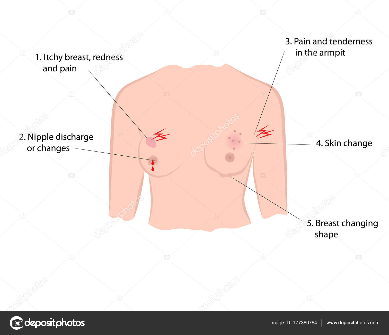 причины онкологии груди у женщин фото 58