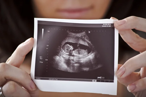 30 недель беременности: Как подготовиться к скорому появлению малыша