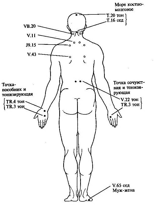 Иглоукалывание точки на теле схема и что лечит