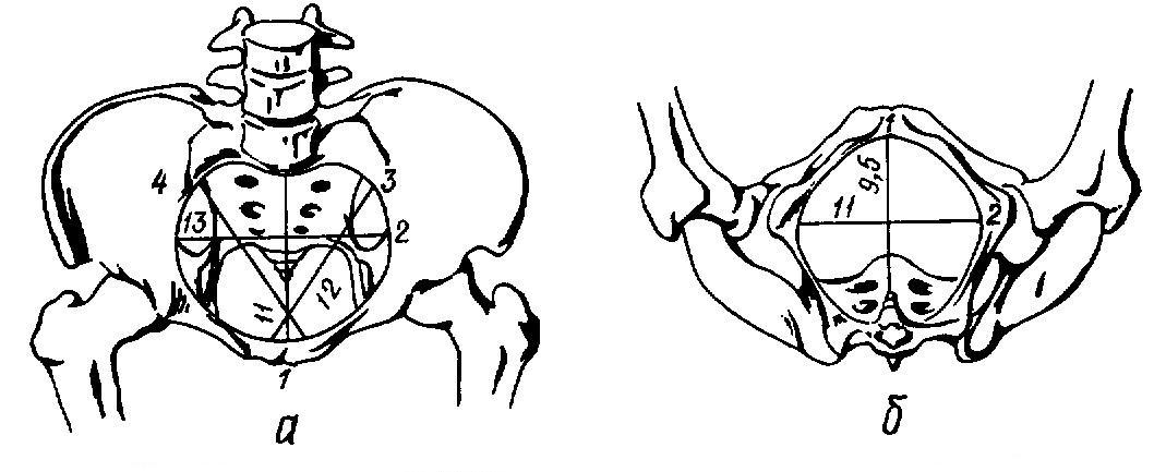 Акушерские размеры таза на рисунке