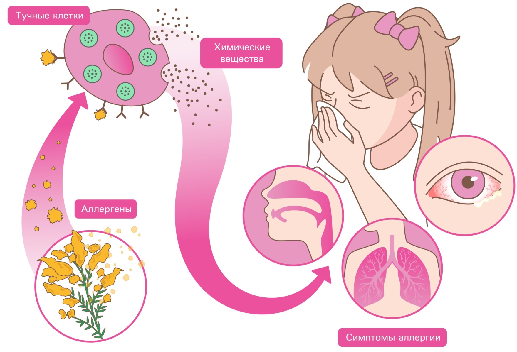 Как распознать аллергию у малыша до года: Неожиданные симптомы и решения