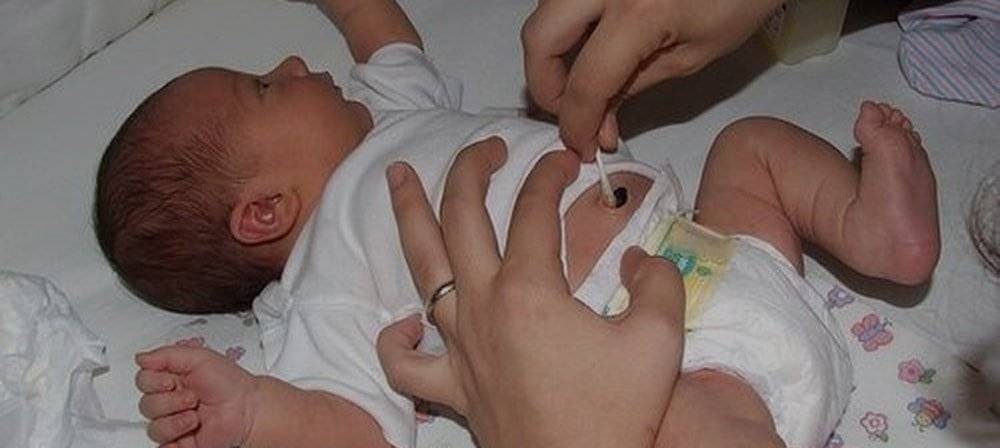 Как правильно ухаживать за пупком младенца: Секреты обработки марганцовкой