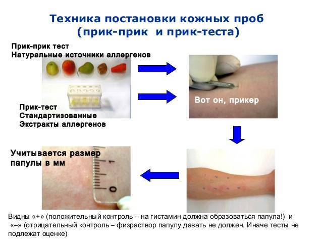 Аллергия на антибиотики у детей: как распознать и что делать