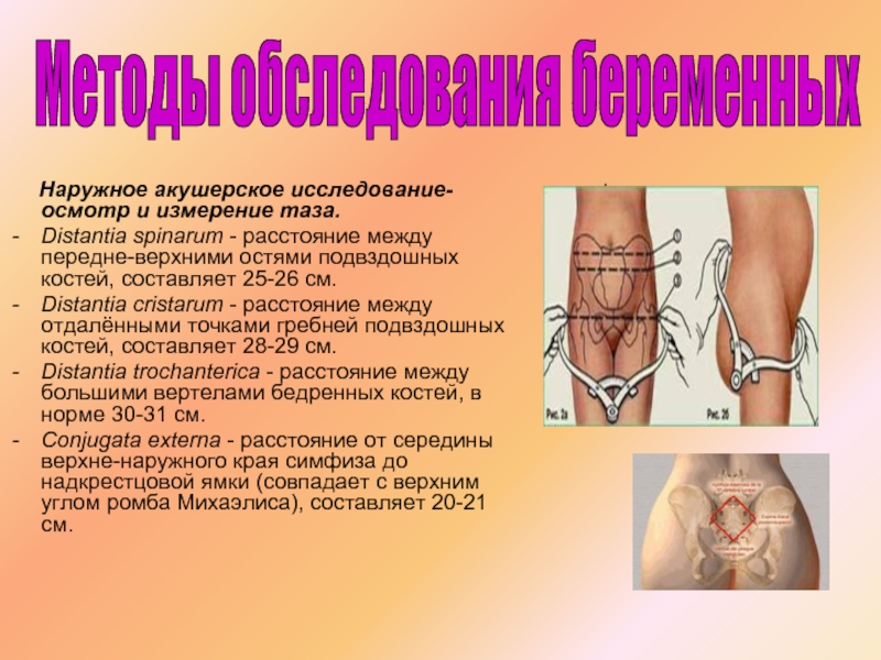 Как правильно измерить таз беременной: Секреты точной пельвиометрии