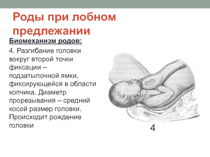 Как проходят роды при заднем виде затылочного предлежания: Путь к безопасному рождению