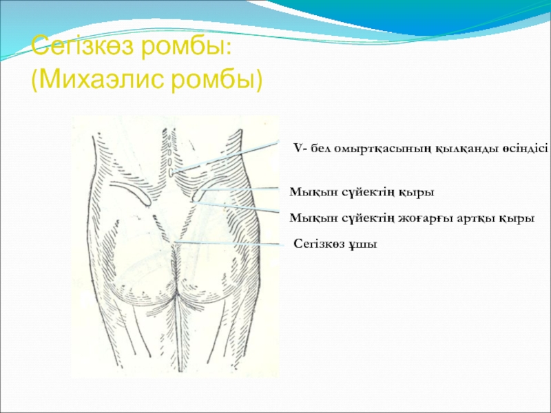 Как оценить таз беременной: Ромб Михаэлиса раскрывает секреты акушерства