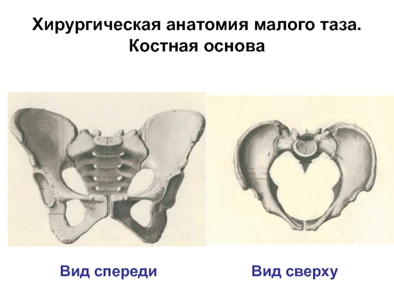 Малый таз. Большой и малый таз анатомия. Большой и малый таз границы. Хирургическая анатомия таза.