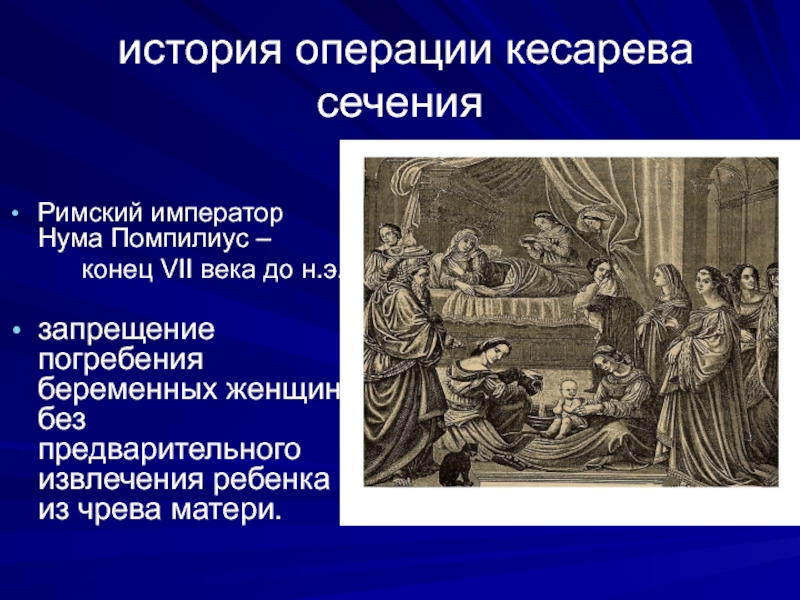 Исторический операция. Кесарево сечение история. Кесарево сечение в древности. История кесарево сечение Акушерство. Кесарево сечение в древнем Риме.