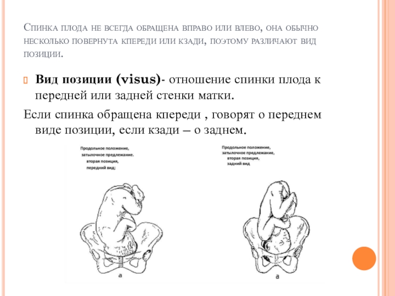 Затылочное предлежание плода передний вид. 1 Позиция передний вид затылочного предлежания. Головное предлежание плода 2 позиция.