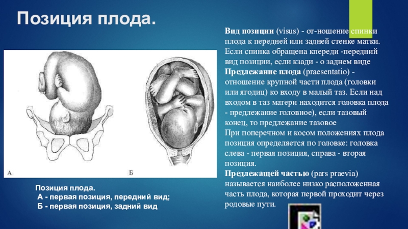 Справа б. Спинка плода спереди слева. Передний вид плода. Передний вид позиции плода. Задний вид позиции плода.