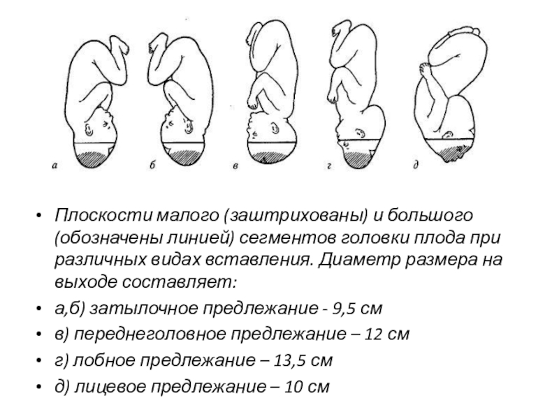 Вставление головки виды