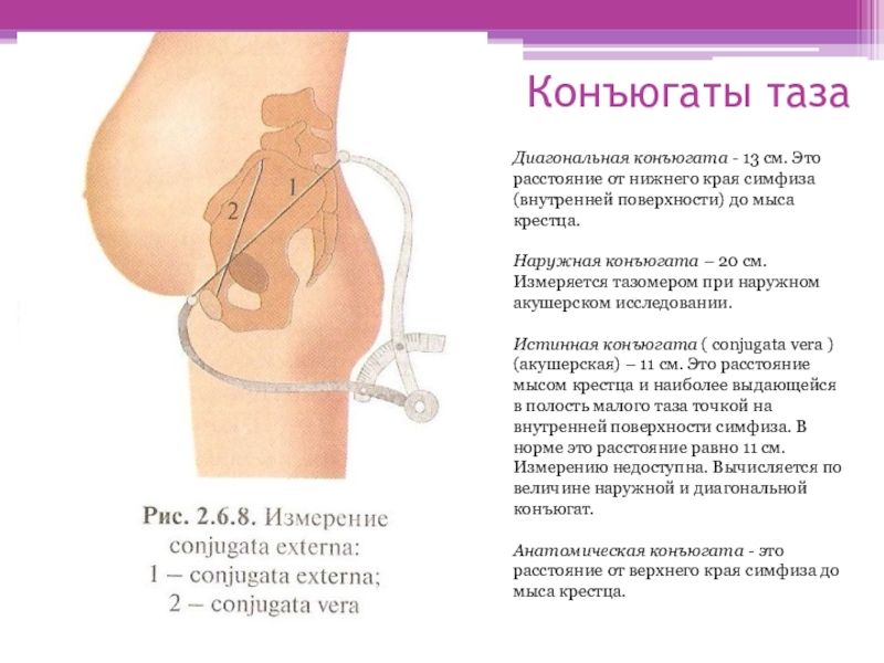 Женский таз с акушерской точки зрения презентация