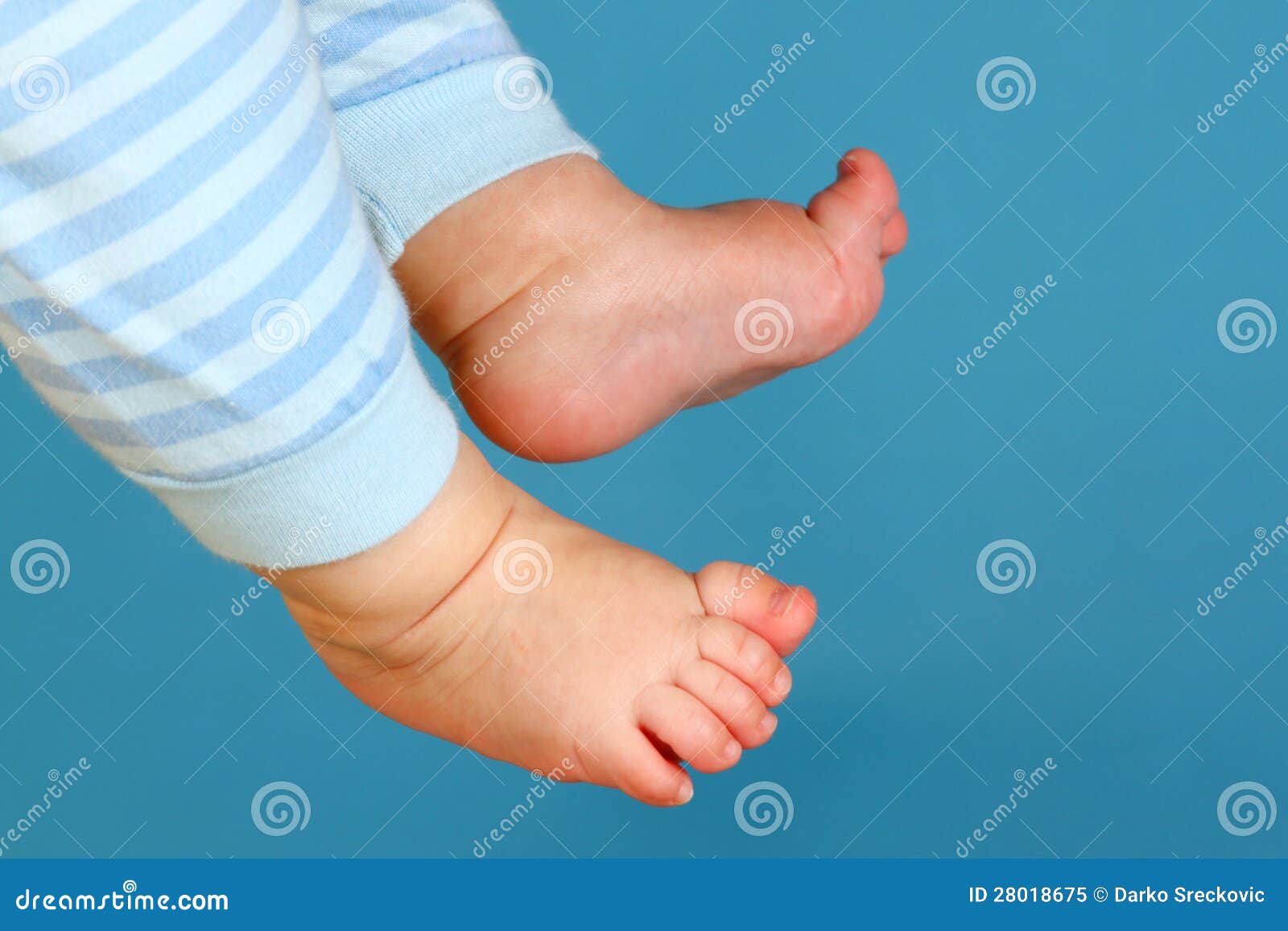 Рука нога когда у ребенка