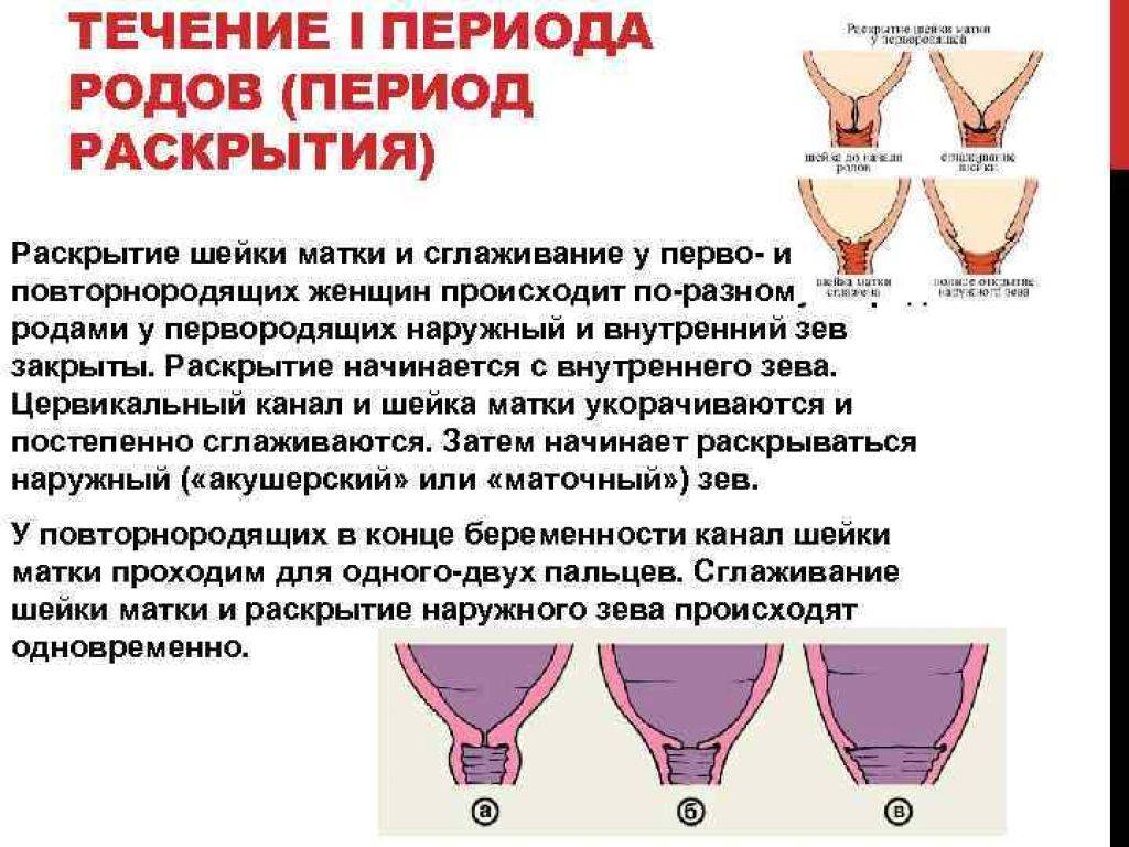 Как раскрывается шейка матки перед родами у повторнородящих фото