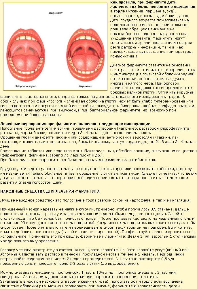 Как быстро вылечить ларингит и ангину: Секреты эффективной терапии