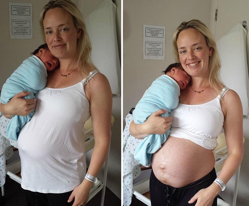 До и после беременности фото. Женщины после рождения. Фотосессия женщин после родов.