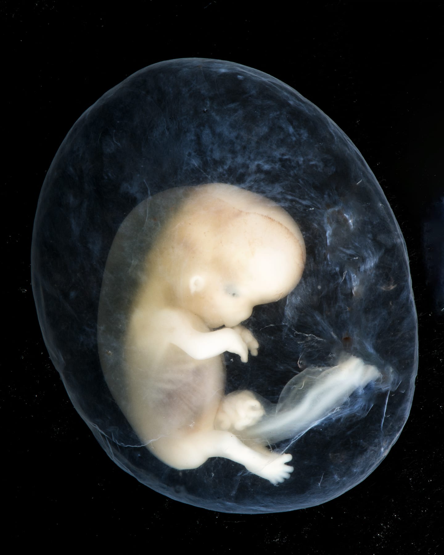 Как выглядит плод в 2 месяца беременности фото