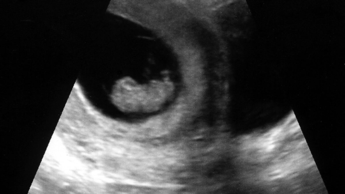 9 неделя видео. 10 Недель беременности фото ребенка. УЗИ 9 недель беременности.