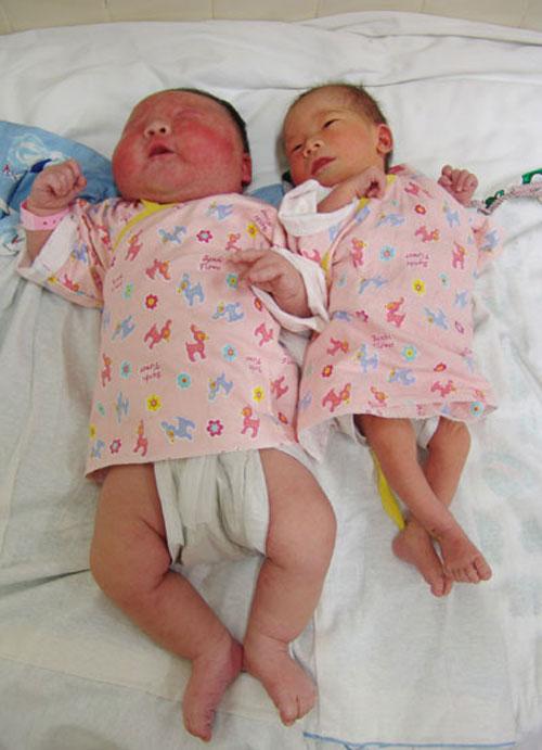 Первая неделя после рождения. Новорожденные дети. Крупные Новорожденные дети. Новорожденный весом 2 кг.