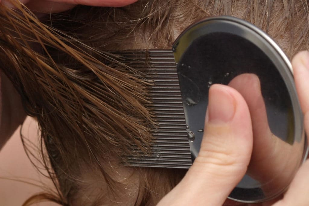 Как защитить свои волосы от вшей