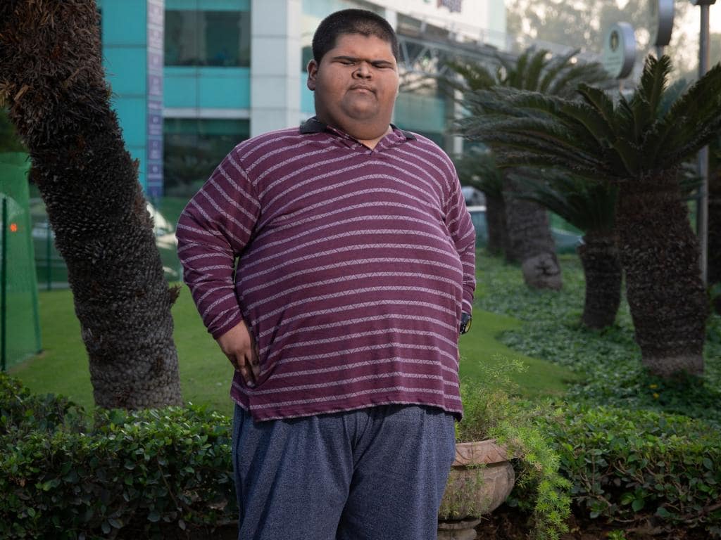 Покажи толстого мальчика. Михир Джаин. Толстый подросток. Толстый толстый мальчик.