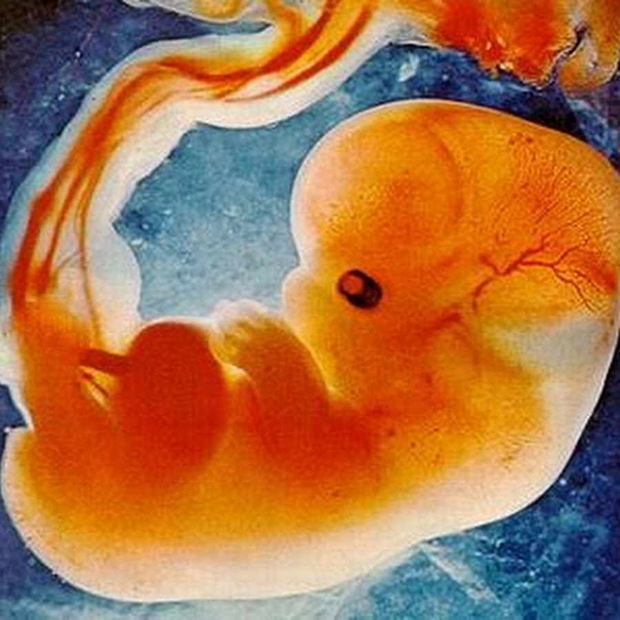 эмбрион на 10 день
